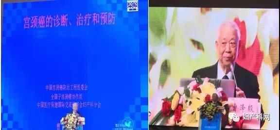 中国宫颈癌防治工程组委会、全国子宫颈癌协作组、中国医疗保健国际交流促进会妇产科分会曹泽毅教授1